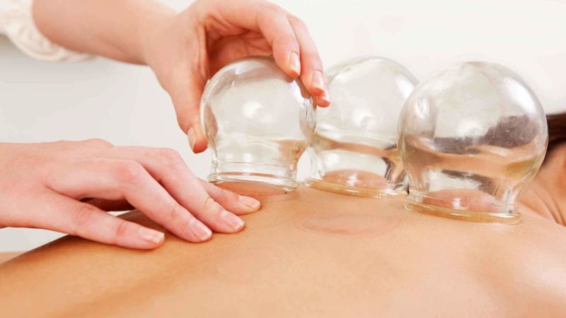 Lymphatic Cupping Therapy